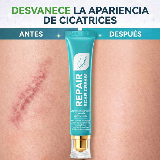 Deja de tapar tus cicatrices y empieza a repararlas — SADOER Repair Cream + Envío Gratis 🎁